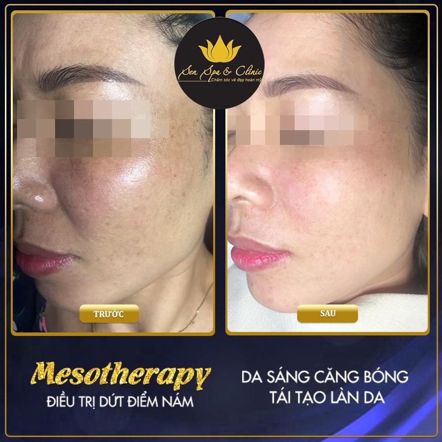 spa tại ninh kiều, cần thơ