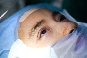 nhấn mí mắt bị lỗi