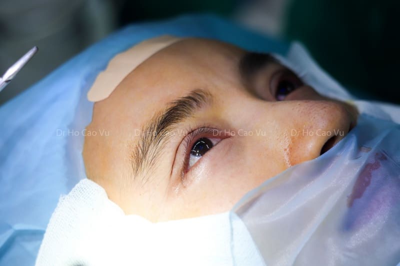 nhấn mí mắt bị lỗi