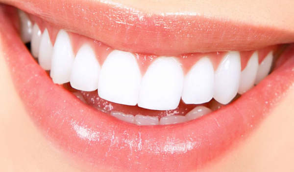 How to choose best tooth whitening products - Howtowise